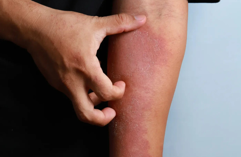 A man scratching his arm