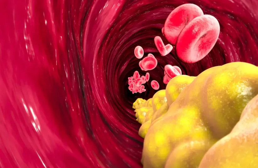 Cholesterol is influenced not only by diet, but also by what the body and mind have gone through in recent months