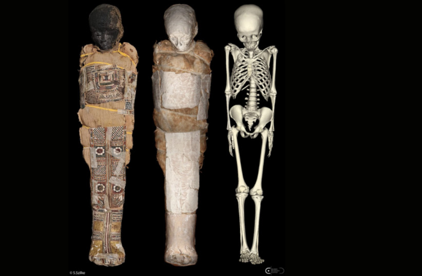 Current state of preservation of the mummy (L), 3D visualisation of the mummy: VR (C), and segmentation of the skeleton (R), April 23, 2026.