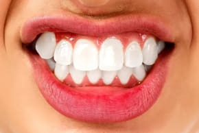  Teeth grinding
