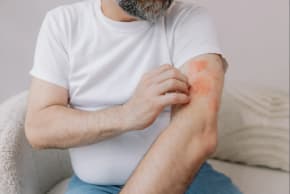 A man with skin irritation and redness