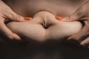 Abdominal fat