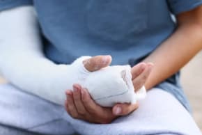 A broken arm