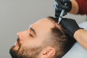 “Turkey’s hair transplant market is shifting toward natural results and medical quality.”