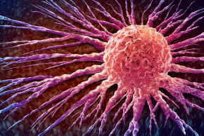 Concepto anatómico de la propagación de las células cancerosas y la oncología, o del crecimiento maligno y la metástasis, representado mediante una ilustración en 3D que muestra el crecimiento de las células tumorales y la propagación de la enfermedad maligna a través de la metástasis. 