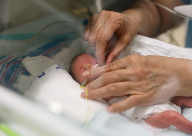 Doctors at Rambam Hospital use a new method for providing respiratory assistance to premature babies.