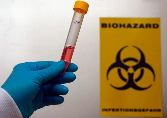  A technician poses for the media with a test tube for testing against pandemic influenza A (H1N1) virus in the national reference laboratory at the Robert Koch scientific institute in Berlin, October 2, 2009