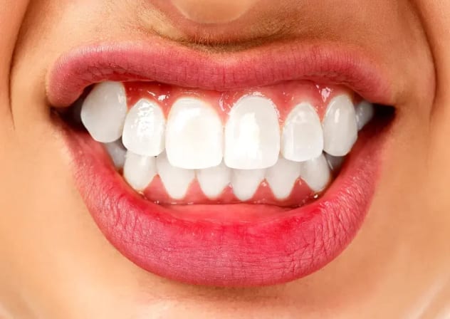  Teeth grinding