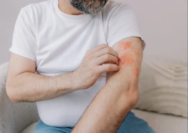 A man with skin irritation and redness