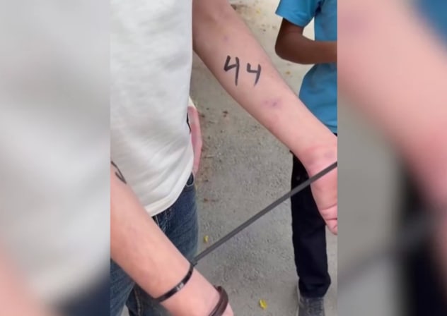 Palestinian with the number 44 drawn on his arm by IDF soldiers operating in the West Bank, August 18, 2026.