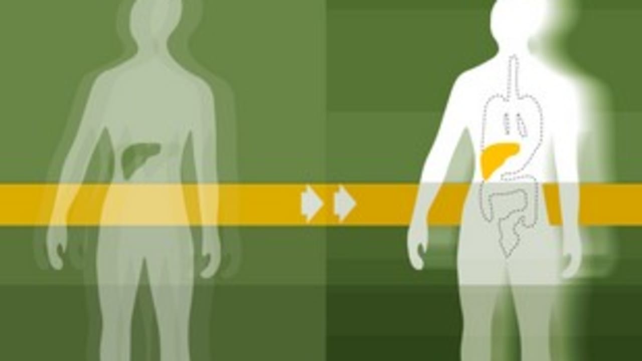 Organ Transplant [illustrative]
