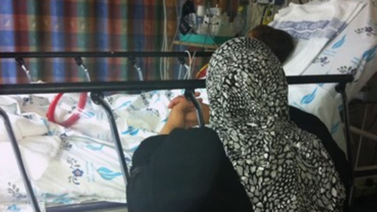 Syrian girl after surgery hospital 370