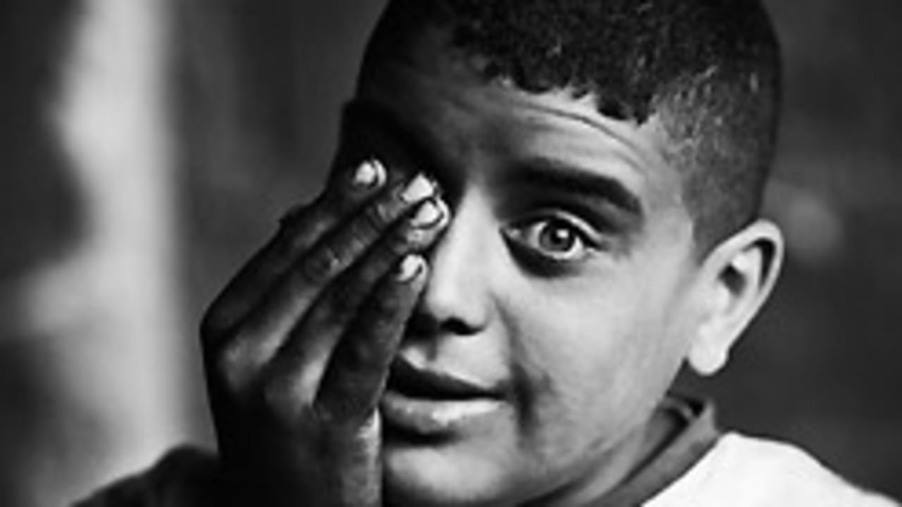 boy covering eye 248 88