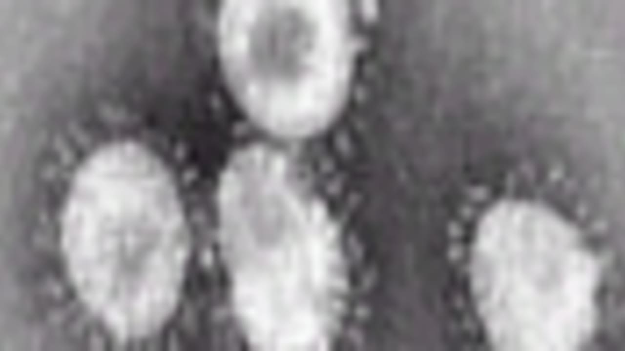 flu 88