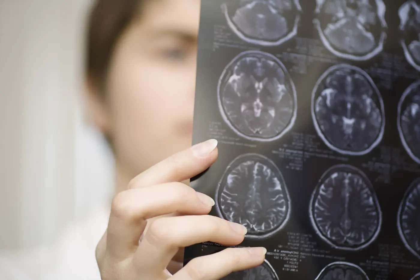 A doctor looks at a brain X-ray (photo credit: SHUTTERSTOCK)