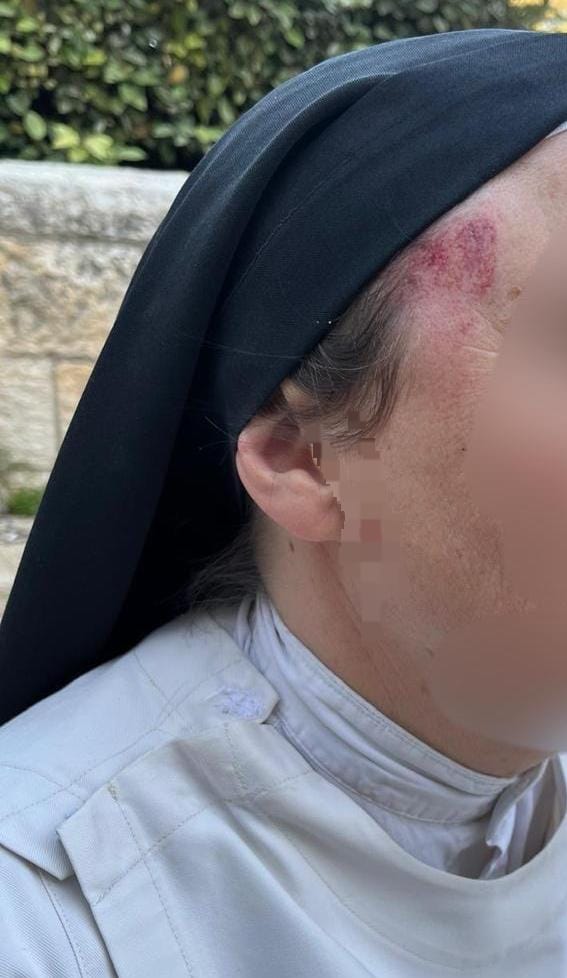 ‘Assault on city’s fundamental values’: Attack on nun in Jerusalem sparks...
