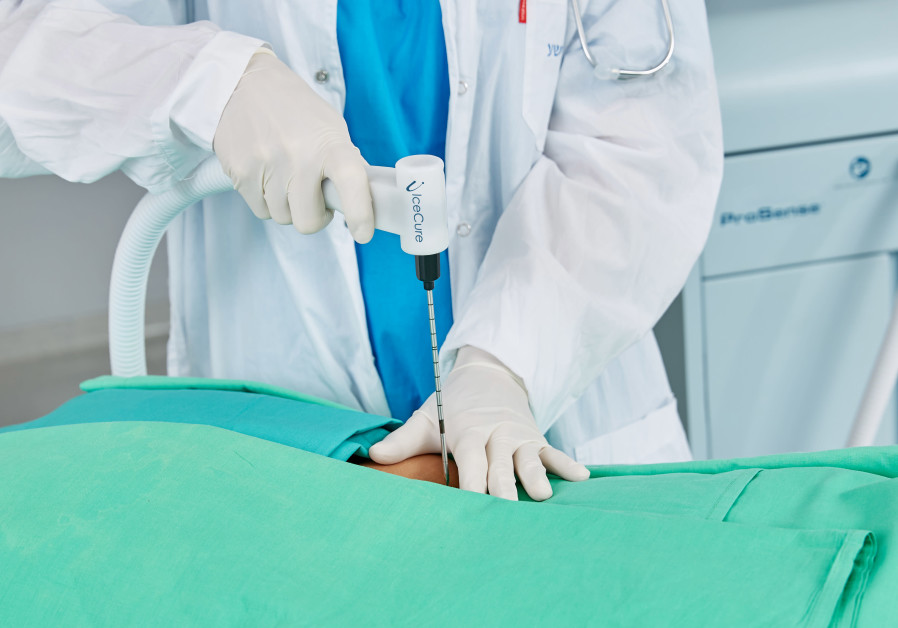 An illustrative image of IceCure's cryoablation probe being inserted into the body during a procedure. (Courtesy: IceCure)