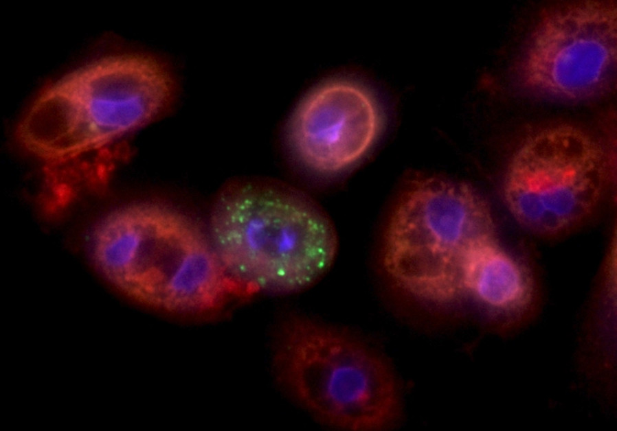 Lung cells infected with coronavirus (Credit: Yaakov Nahmias)