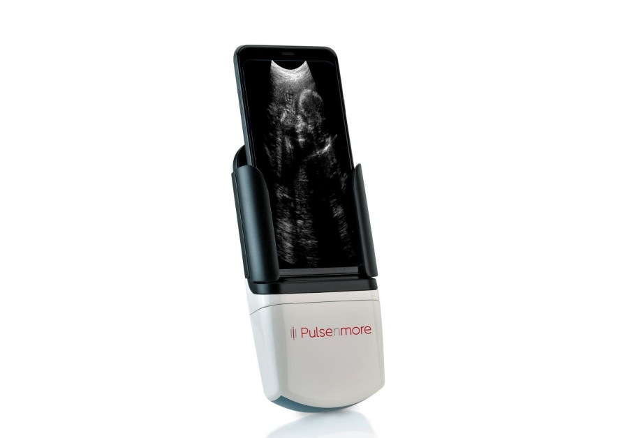 Israeli startup PulseNmore's at-home ultrasound machine (Credit: PulseNmore)