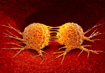   Dividing cancer cell