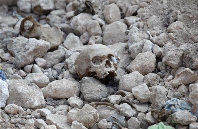 A skull and human bones (photo credit: AP)