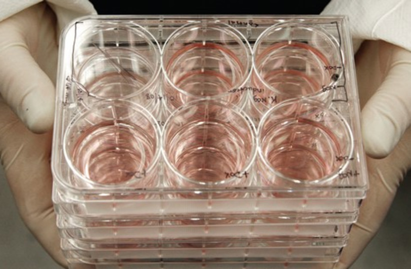 Stem cells (photo credit: Associated Press)