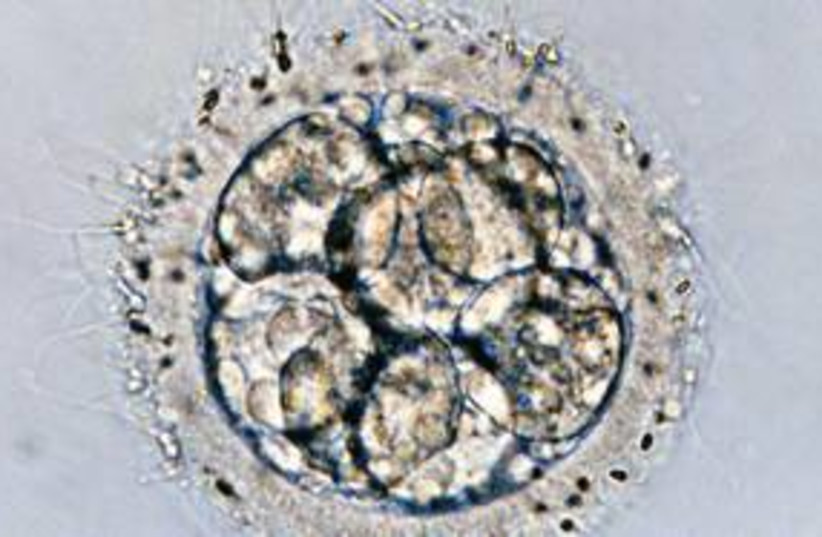 Sperm cells surround an embryo 311 (photo credit: Debbi Morello/Detroit Free Press/MCT)