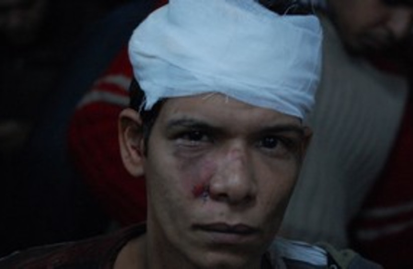 Demonstrator injured in Cairo 311 (photo credit: Courtesy/The Media Line)