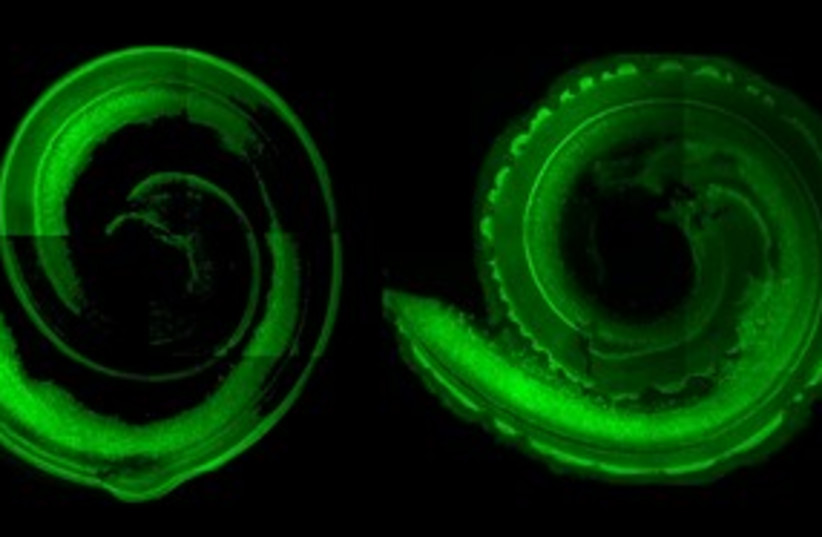 Images of mouse cochlea 311 (photo credit: PLoS Biology )