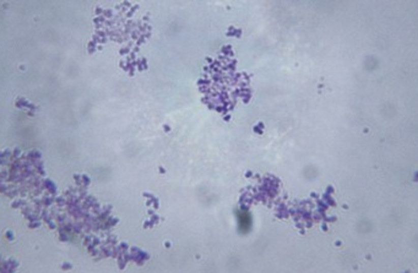 bacteria under microscope_370 (photo credit: Thinkstock/Imagebank)