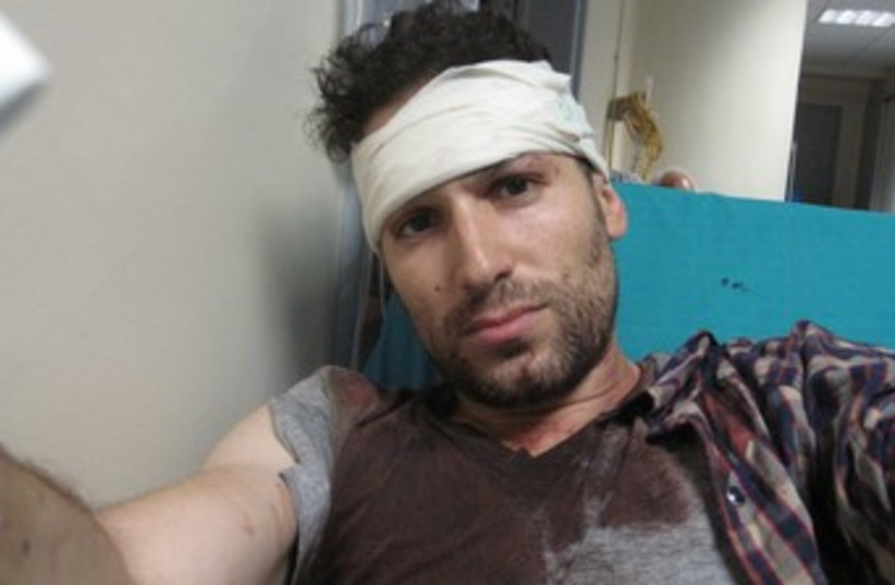 Gil Shefler after being attacked by Greek mob 370 (photo credit: Gil Shefler)