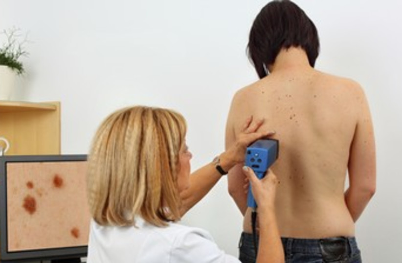 Patient tested for skin cancer 370 (photo credit: Thinkstock)