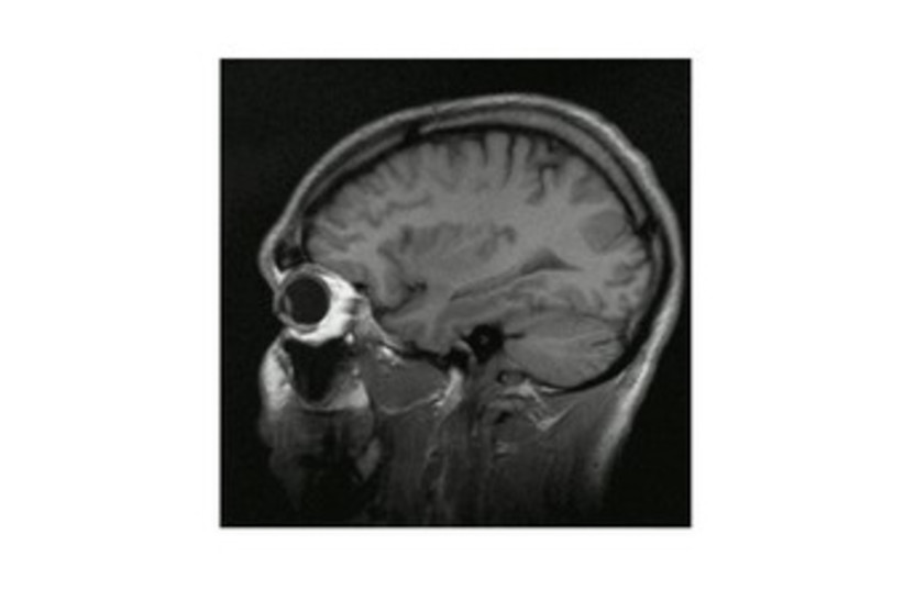 brain (photo credit: Wikicommons)
