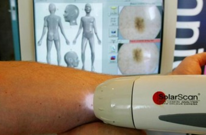 Device that detects skin cancer 370 (photo credit: REUTERS/Mark Baker)