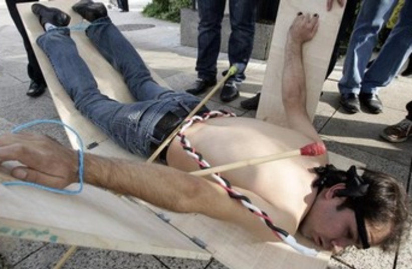 Syrian opposition member shows ways of torture 370 (photo credit: REUTERS/Cynthia Karam)