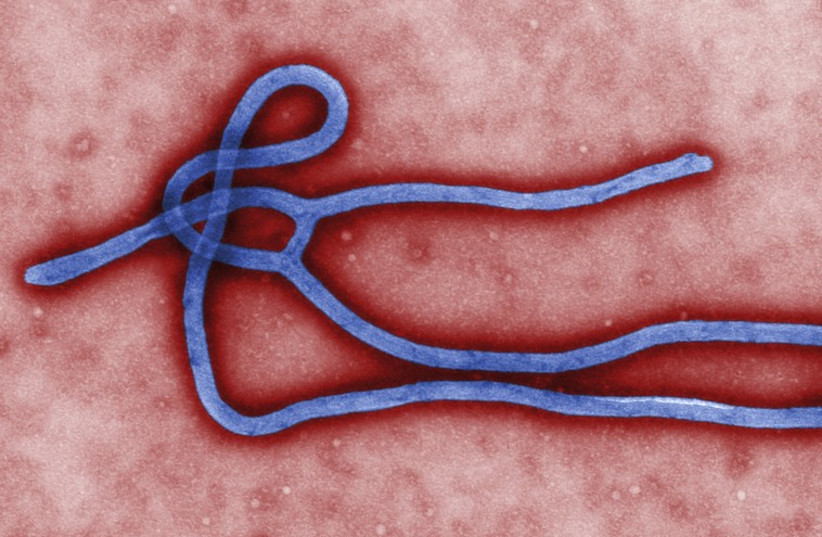 Some of the ultrastructural morphology displayed by an Ebola virus (photo credit: REUTERS)