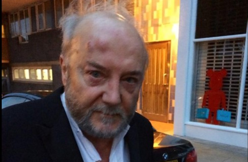 George Galloway heads to the hospital, August 29, 2014. (photo credit: TWITTER/THE RESPECT PARTY)