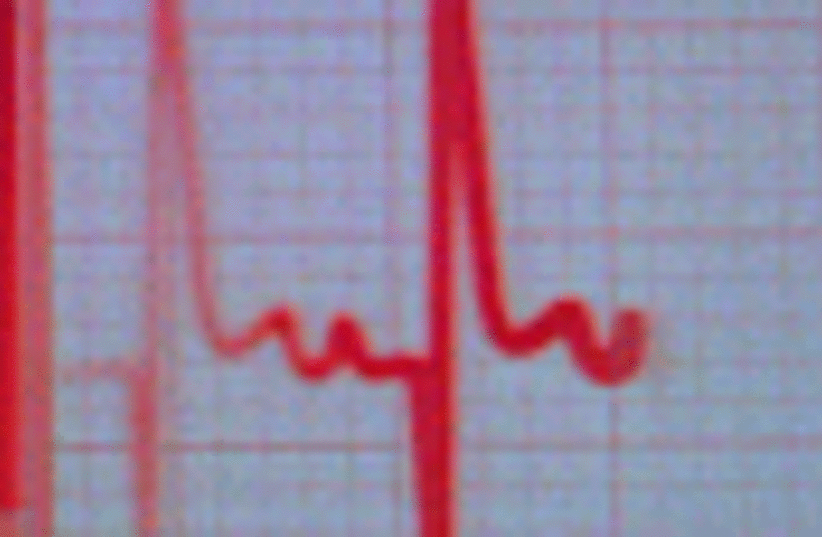 heart monitor 88 (photo credit: )