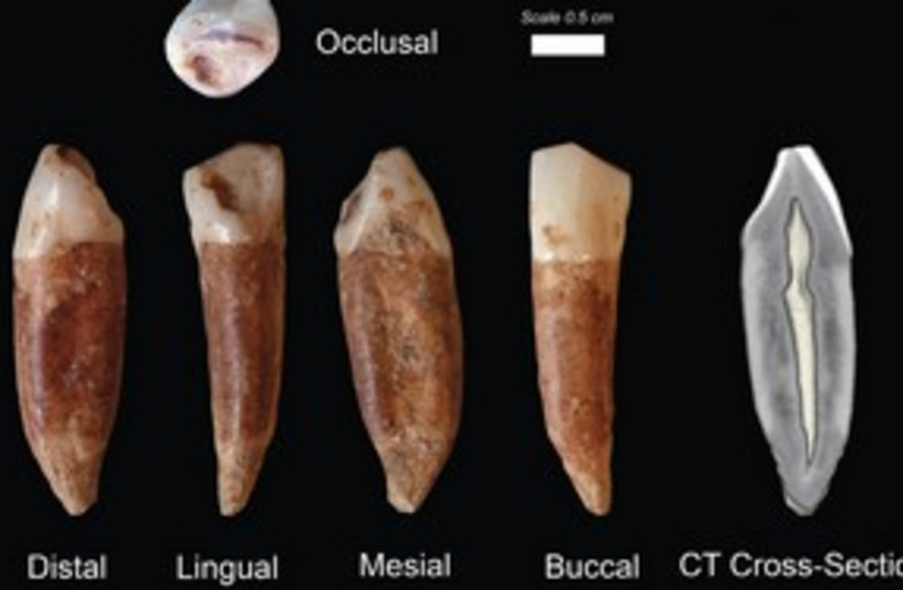 Teeth from Qesem cave 311 (credit: Prof. Israel Hershkowitz/TAU)