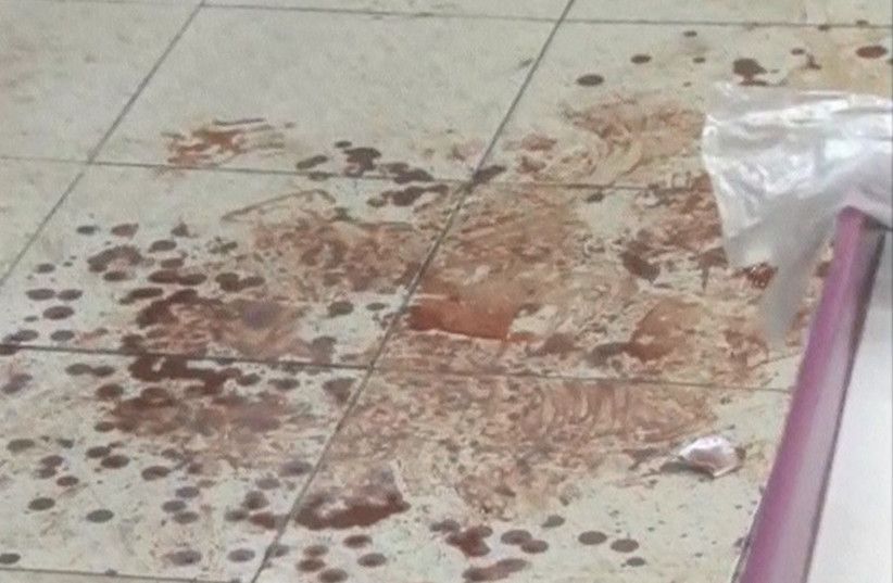 Bloody scene of attack near Jerusalem. December 3, 2014