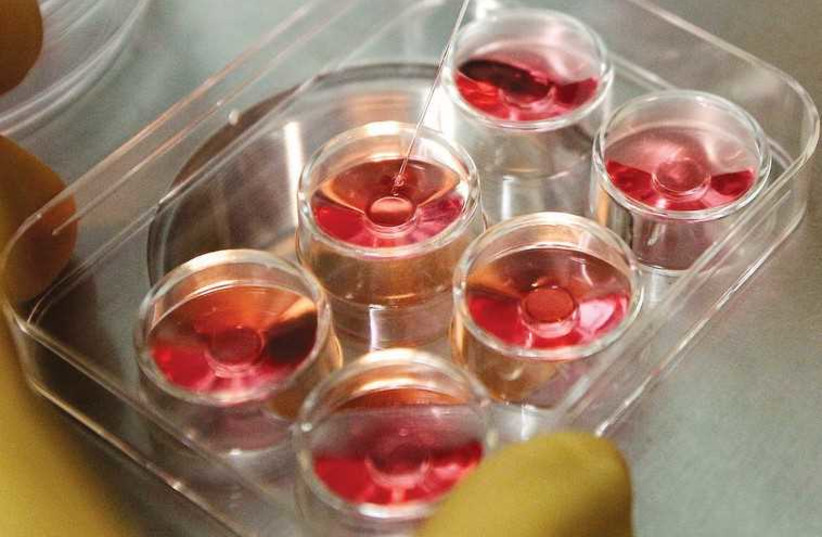 The process of extracting eggs in a lab in a fertility clinic. (credit: REUTERS)