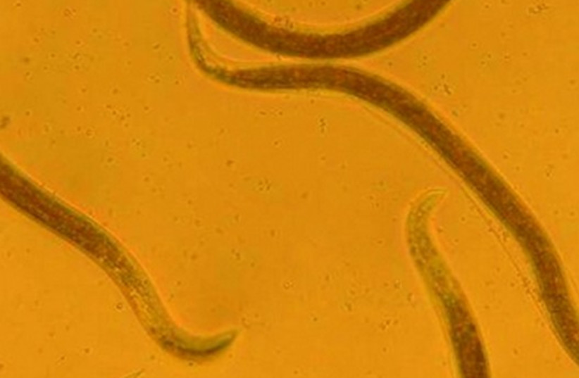 Nematode worms. (credit: BIOBEE)