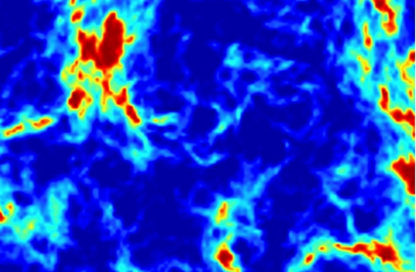 Pattern of radio waves on the sky caused by the combination of radiation from the first stars and the effect of dark matter. Blue regions are those where the dark matter cooled down the ordinary matter most strongly.  (photo credit: PROF. RENNAN BARKANA)