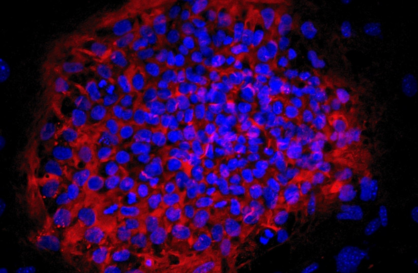 A colony of haploid embryonic stem cells (credit: AZRIELI CENTER FOR STEM CELLS AND GENETIC RESEARCH/HEBREW UNIVERSITY OF JERUSALEM)