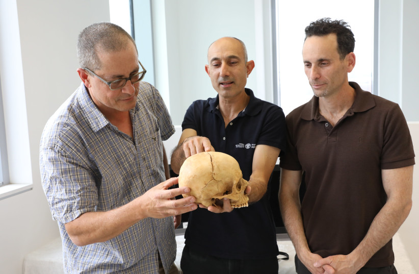 Prof. Boaz Zissu Dr. Yossi Nagar and Dr. Haim Cohen with the skull (photo credit: CHEN GALILI/TEL AVIV UNIVERSITY)