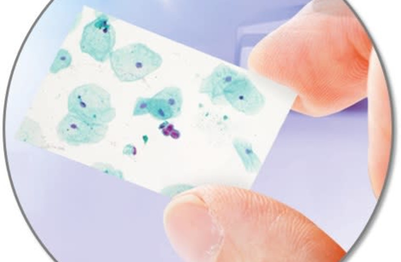 Identification of cancer cells using Micromedic's CellDetect platform (photo credit: MICROMEDIC)
