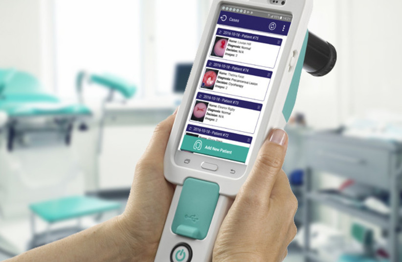 Israeli AI transforms cervical cancer screening - Israel News - The ...