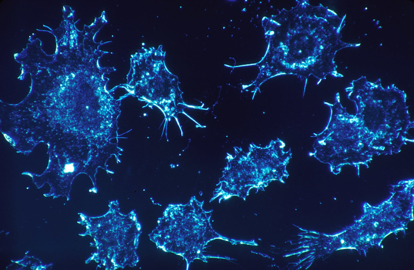 Cancer cells [illustrative] (credit: PIXABAY)