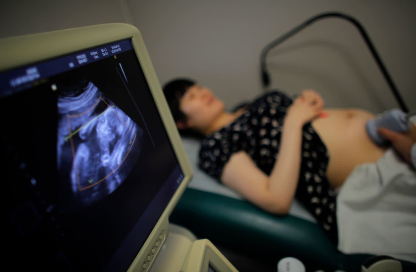 Wu Tianyang, who is five month pregnant with her second child, attends a sonogram at a local hospital in Shanghai September 12, 2014.  (credit: CARLOS BARRIA / REUTERS)