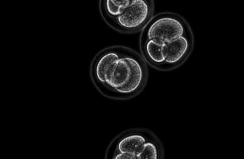 Cells seen under a microscope (photo credit: Courtesy)
